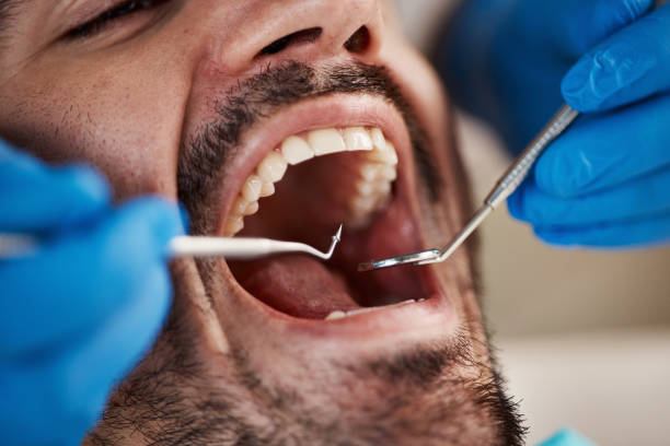 Best Pediatric Emergency Dentist in Hickman, KY