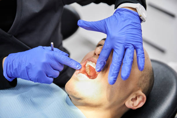 Best Emergency Dentist for Knocked-Out Tooth in Hickman, KY